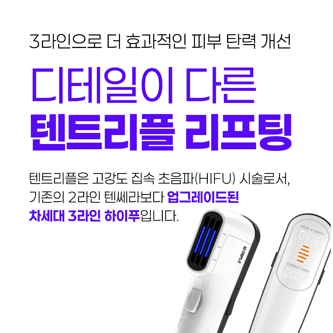 텐트리플