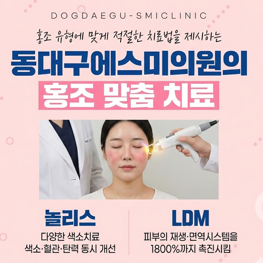 홍조 맞춤 치료